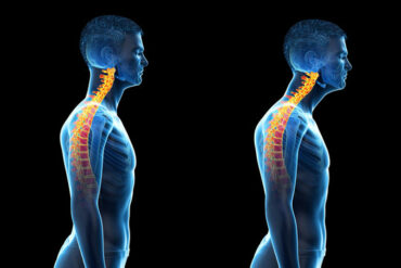 Thoracic Spine Anatomy and Upper Back Pain