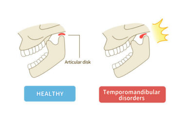 Everything you need to know about TMJ disorders